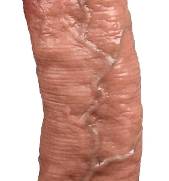 10 23" Silicone Realistic Dildo with Large Rounded Glans, Huge Thick Dildos Anal Plug with Strong Suction Cup, Butt Plugs Sex Toys for Men Women Clitoral Vaginal and Anal Stimulation(M)
